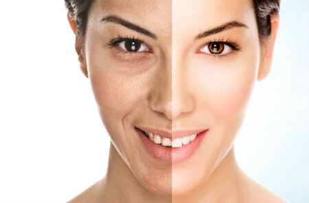 Trẻ hóa làn da bằng công nghệ tế bào gốc là giải pháp tối ưu nhất giúp chị em sở hữu khuôn mặt trẻ trung và xinh đẹp.